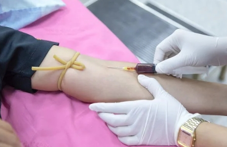 【注射器測(cè)試儀科普】注射器在防艾中的作用